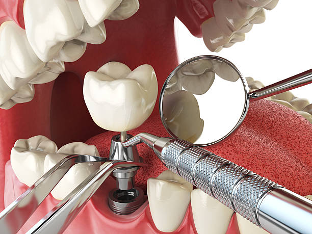 Best Urgent Tooth Repair  in Mino, CA