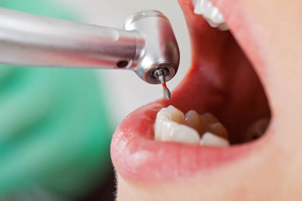 Best Tooth Infection Emergency Dentist  in Mino, CA